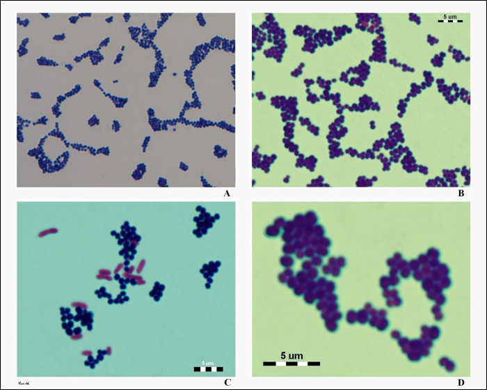 Staphylococcus aureus gram microscope stain oil immersion epidermidis stained