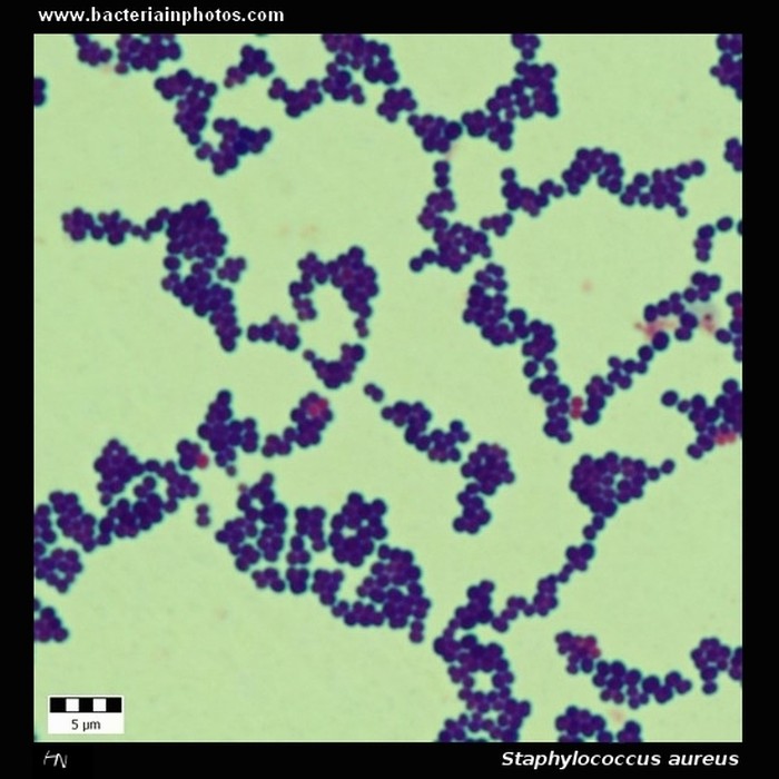 Staphylococcus aureus under microscope 1000x