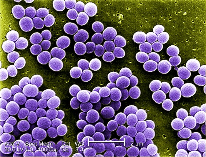 Staphylococcus aureus under microscope 1000x